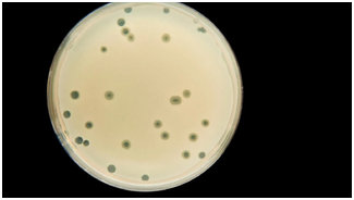 Бактериальных инфекций / Бактерии