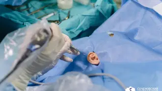 В России впервые восстановили барабанную перепонку с помощью клеточных технологий