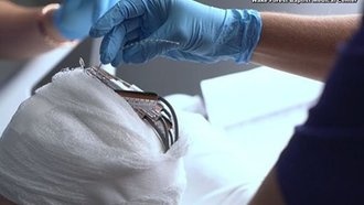 «Ускоритель памяти» – создан киберчип, усиливающий память человека