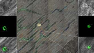 Будущее медицинских имплантатов — 3D-печать электроники внутри живых организмов