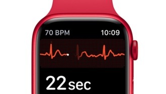 Часы Apple Watch разбудили владельца, предупредив об опасном для жизни тромбе