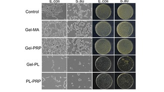Гидрогель с аминокислотами — эффективное средство для лечения ран