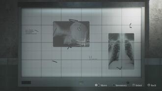 Как решить головоломку с рентгеном в больнице Брукхейвен в ремейке Silent Hill 2