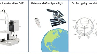 Ухудшение зрения астронавтов в космосе