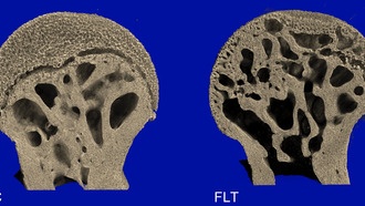 Потеря костной массы у мышей на МКС