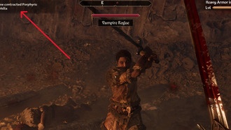 Лекарства от вампиризма в Oblivion Remastered