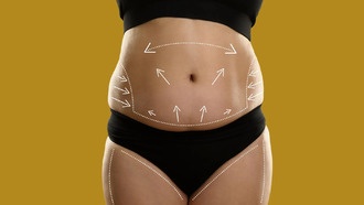 Пациенты после абдоминопластики продолжают худеть в течение пяти лет