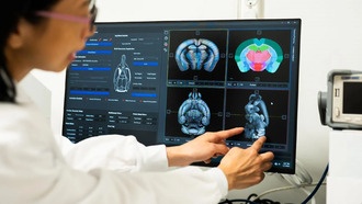 Креатин может перепрограммировать мозг — ученые нашли способ его доставки