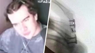 Российский стример Bratishkin после операции шутит, что стал похож на Росомаху