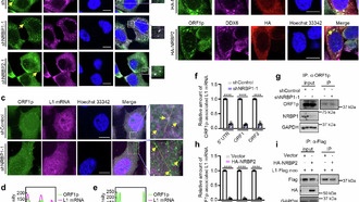 Учёные раскрыли механизм защиты генома от «внутренних врагов»