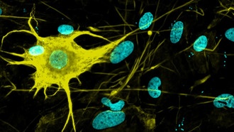 Учёные вырастили более 400 типов нервных клеток — прорыв в исследованиях Альцгеймера и Паркинсона