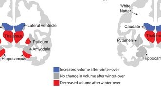 Длительная изоляция в Антарктиде вызывает временную потерю серого вещества мозга