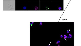 Наночастицы научили не только доставлять лекарства, но и лечить