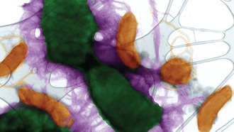 Бактерии используют белок, связанный с болезнью Альцгеймера, для защиты от угроз