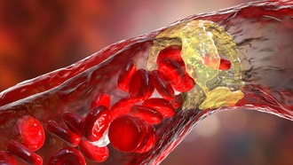Кардиологи рекомендуют начинать лечение с максимальных доз статинов