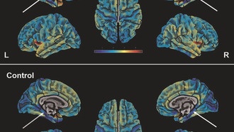 Чатботы дают опасные советы, древнеримский бетон и связь депрессии с мозгом