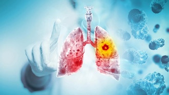 Новый метод лечения рака легких: трансплантация митохондрий усиливает иммунитет и эффективность химиотерапии