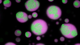 Учёные разгадали тайну скоплений РНК в мозге и научились их растворять