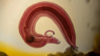 Паразитический червь отключает болевые сигналы, чтобы проникнуть в организм