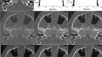 Квантовая математика улучшает качество медицинских снимков
