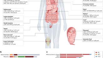 Как микропластик и нанопластик влияют на здоровье? Всё зависит от их концентрации и методов измерения