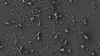 Ученые составили карту жизненно важных генов бактерии Mycoplasma pneumoniae
