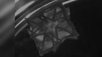 Учёные создали 3D-печатный «заплатку» для сердца, которая интегрируется в ткань