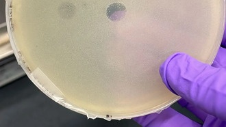 Археи производят антимикробные вещества, убивающие бактерии