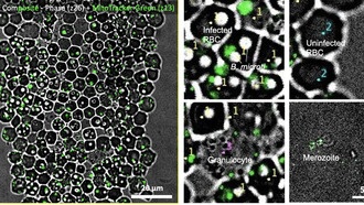 Учёные создали микрофлюидную платформу для изучения паразита, вызывающего бабезиоз
