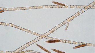 Расшифрованы геномы бурых водорослей: открыты древние истоки и эволюционная судьба половых хромосом