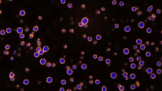 Учёные обнаружили новый механизм формирования клеточных структур, связанных с раком