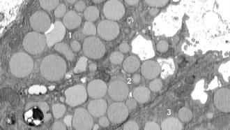 Клетки «извергают» отходы для ускорения заживления, но это повышает риск рака