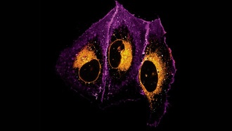 Учёные разработали метод количественной визуализации транспорта липидов в клетках