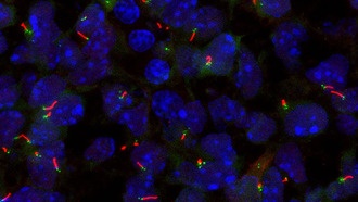 Учёные нашли гены, управляющие развитием первичных ресничек в клетках
