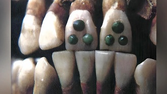 Учёные обнаружили зубы детей майя с нефритовыми вставками