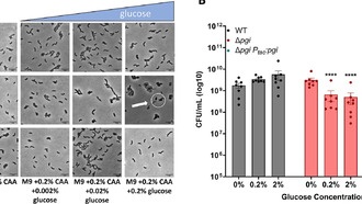 Обнаружена уязвимость бактерий: накопление сахаро-фосфатов разрушает клеточные стенки