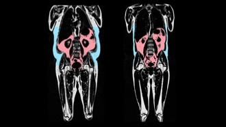 Скрытый жир ускоряет старение сердца даже у физически активных людей