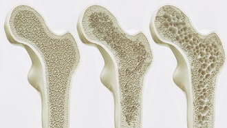 Учёные нашли способ укрепить кости на всю жизнь
