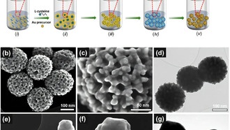 Наночастицы золота с губчатой структурой улучшат диагностику рака яичников