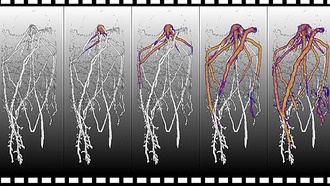 Растения контролируют микробиом корней с помощью распределения сахаров