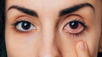 Более половины взрослых страдают от синдрома сухого глаза, но большинство не обращается за помощью
