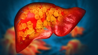 Новый препарат может стать первым средством для остановки смертельно опасной жировой болезни печени