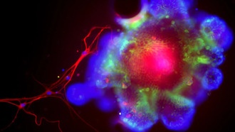 Ученые раскрыли механизм, как алкоголь позволяет бактериям из кишечника разрушать печень