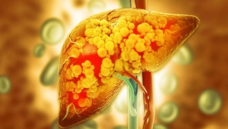 Учёные раскрыли механизм влияния алкоголя на развитие жировой болезни печени
