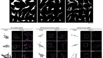 Ученые обнаружили в «темной» части генома механизм реакции клеток на жесткость тканей