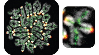 Ученые раскрыли механизм, предотвращающий выкидыши и синдром Дауна