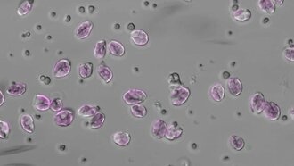 Ученые обнаружили у микроводорослей тот же тип программируемой клеточной смерти, что и у человека