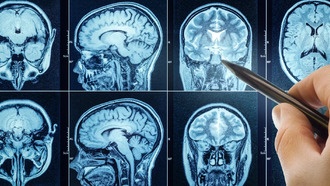 Плохой сон ускоряет старение мозга и может повысить риск деменции