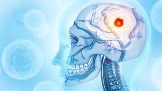 Учёные обнаружили, что глиобластома разрушает череп и перепрограммирует иммунную систему