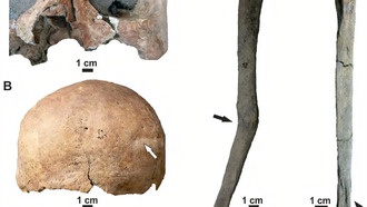 Древние охотники-собиратели Патагонии заботились о раненых и инвалидах